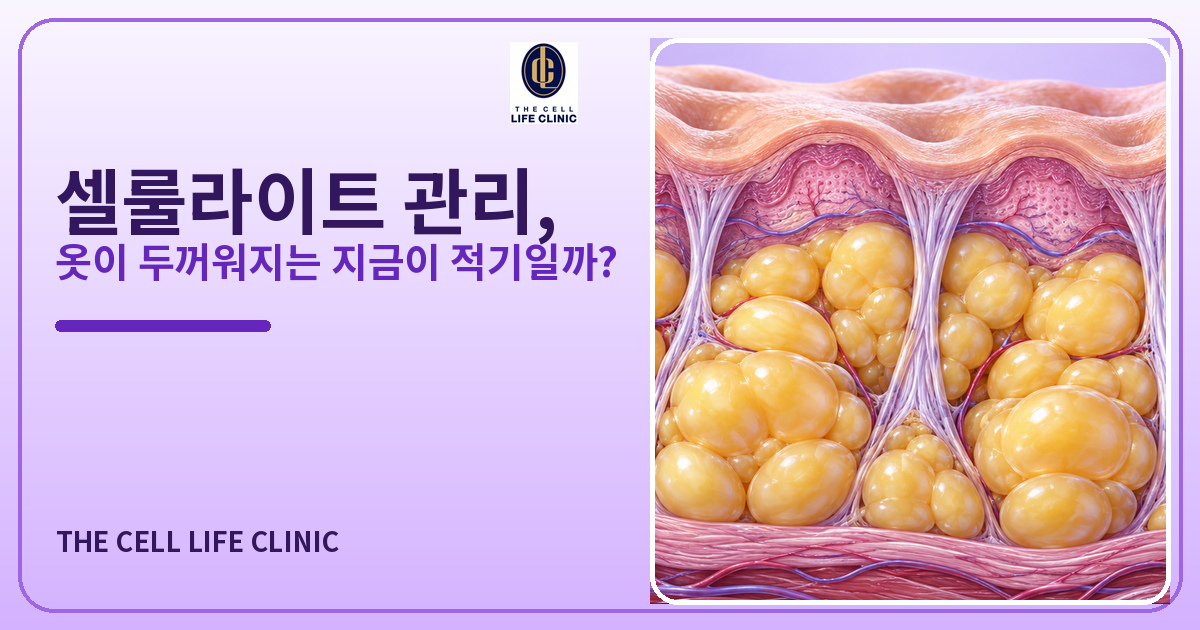 강남 허벅지 셀룰라이트 제거 관리, 왜 하필 가을에 시작해야 할까요?