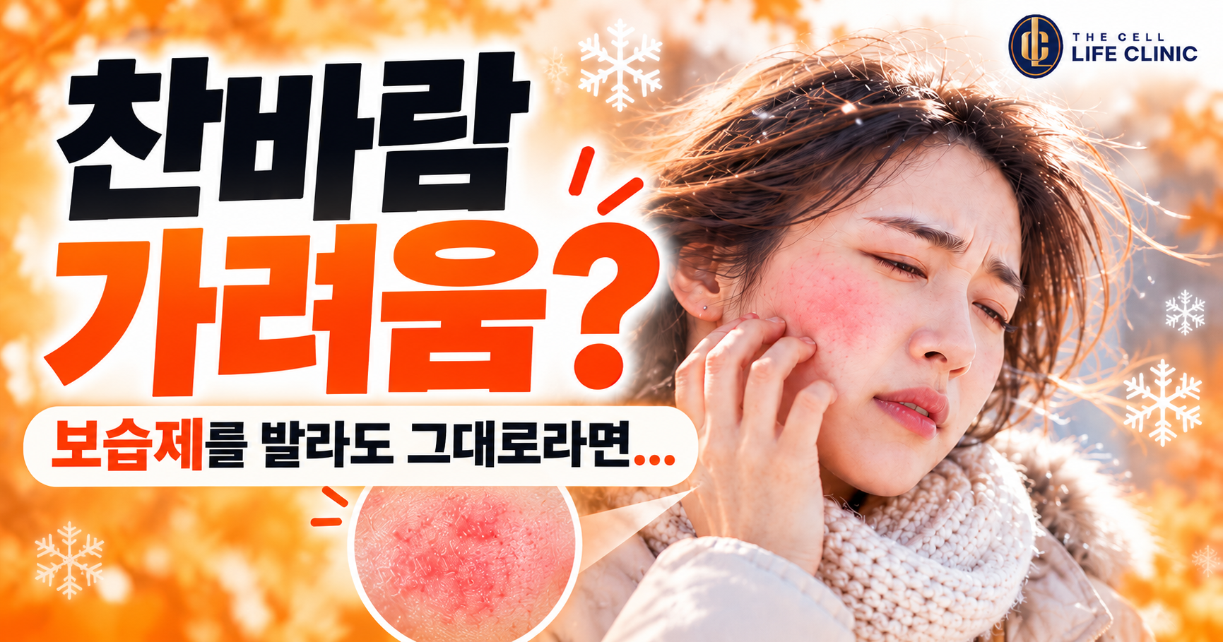 찬바람 맞으면 피부가 붉고 가렵다면? 한랭두드러기 증상과 원인, 강남 양재역 두드러기 진료