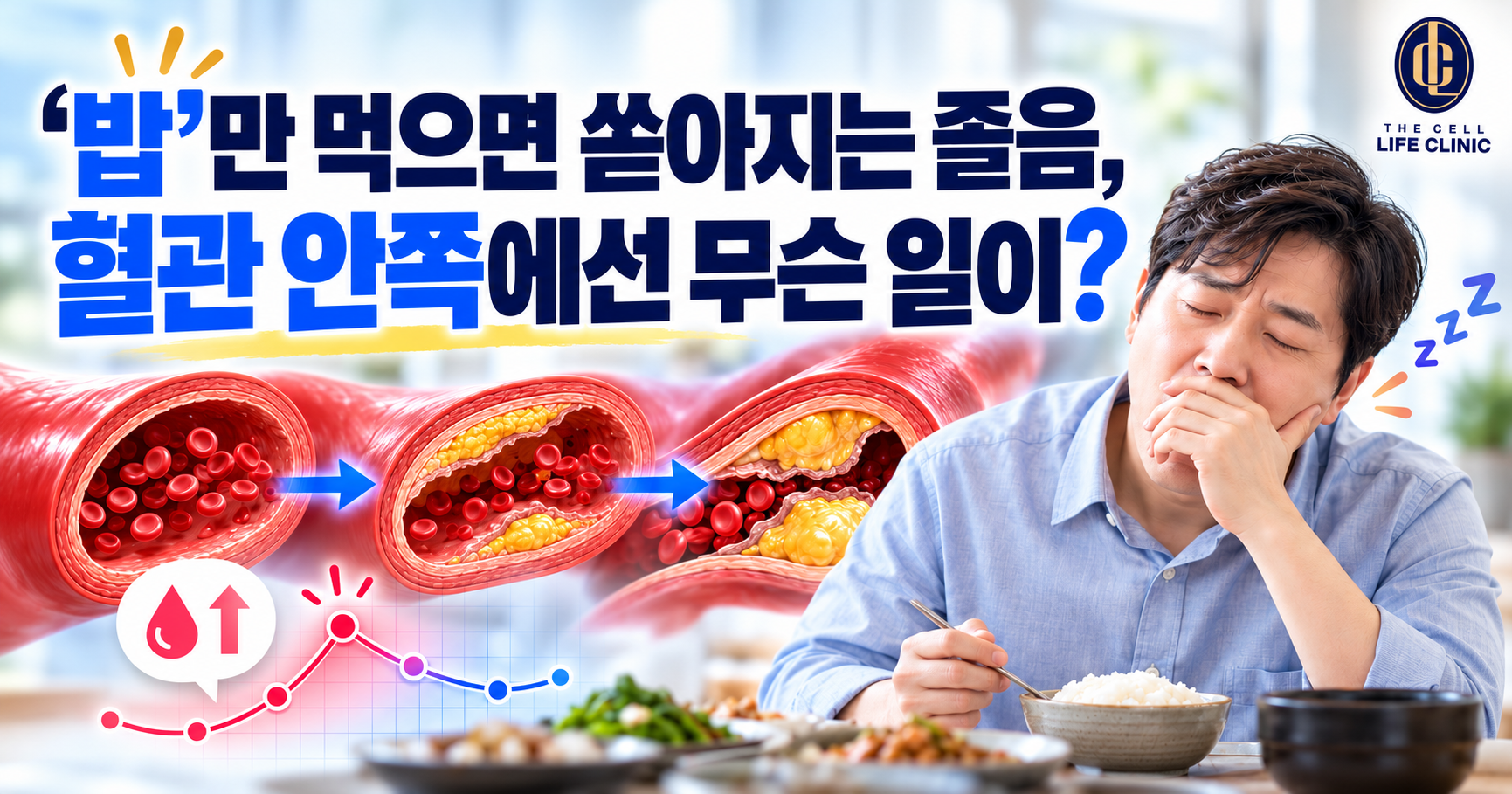 식후혈당 출렁이면 혈관 속 솜털은? 혈당스파이크·동맥경화 관리 | 서울 강남 양재역 라이프의원