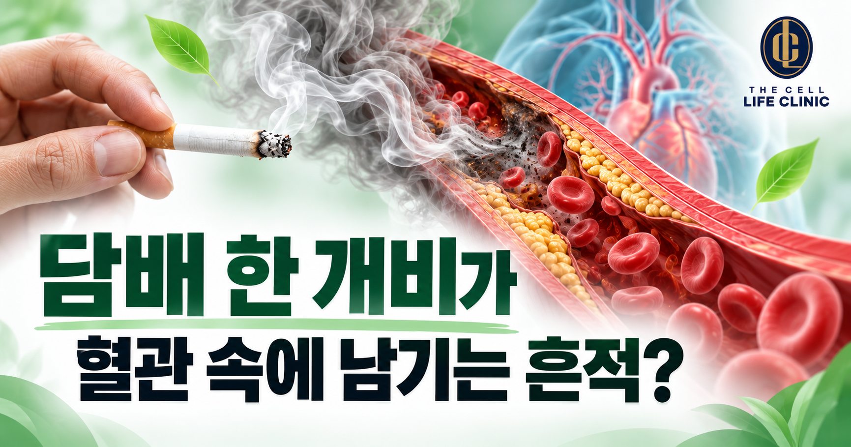 하루 반 갑의 담배, 혈관 속 '솜털'까지 손상시킬까요? 흡연과 동맥경화의 관계 양재역 라이프의원